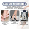 Nail Repair Oil Hand And Foot Repair Inlaid Toenails Soft Nails Daily Moisturizing Nail Care